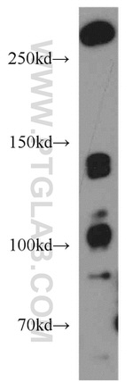 ROBO3 Antibody in Western Blot (WB)