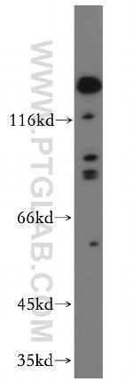 ROBO4 Antibody in Western Blot (WB)