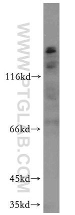 ROBO4 Antibody in Western Blot (WB)