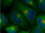 ARF6 Antibody in Immunocytochemistry (ICC/IF)