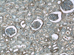 ARF6 Antibody in Immunohistochemistry (Paraffin) (IHC (P))