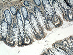 ARF6 Antibody in Immunohistochemistry (Paraffin) (IHC (P))