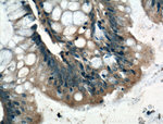 ARF6 Antibody in Immunohistochemistry (Paraffin) (IHC (P))