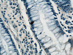 ARF6 Antibody in Immunohistochemistry (Paraffin) (IHC (P))