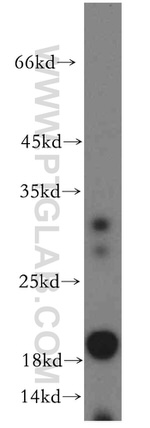 ARF6 Antibody in Western Blot (WB)