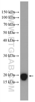 ARF6 Antibody in Western Blot (WB)