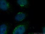 ARF1 Antibody in Immunocytochemistry (ICC/IF)