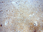 ARF1 Antibody in Immunohistochemistry (Paraffin) (IHC (P))