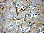 ARF1 Antibody in Immunohistochemistry (Paraffin) (IHC (P))