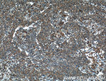 ARF1 Antibody in Immunohistochemistry (Paraffin) (IHC (P))