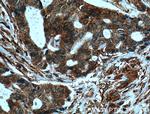 ARF1 Antibody in Immunohistochemistry (Paraffin) (IHC (P))