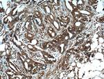 ARF1 Antibody in Immunohistochemistry (Paraffin) (IHC (P))