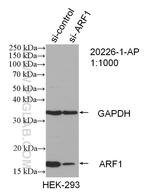 ARF1 Antibody in Western Blot (WB)