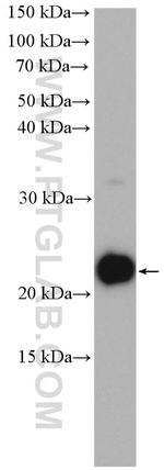 ARF5 Antibody in Western Blot (WB)