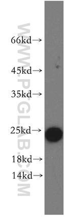 ARF5 Antibody in Western Blot (WB)