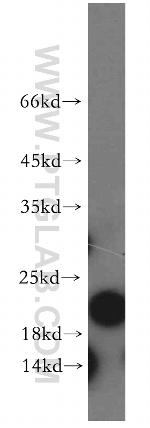 ARF5 Antibody in Western Blot (WB)