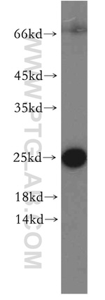 ARF5 Antibody in Western Blot (WB)