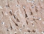 RAB5A Antibody in Immunohistochemistry (Paraffin) (IHC (P))