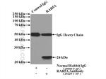 RAB5A Antibody in Immunoprecipitation (IP)