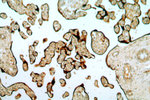 RAB5A Antibody in Immunohistochemistry (Paraffin) (IHC (P))