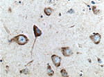 RAB5A Antibody in Immunohistochemistry (Paraffin) (IHC (P))