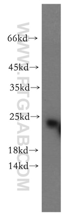 RAB5A Antibody in Western Blot (WB)