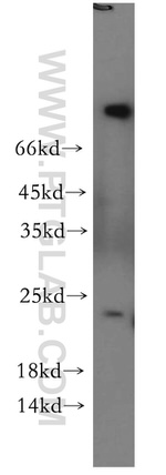 RAB5A Antibody in Western Blot (WB)