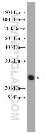 RAB11A Antibody in Western Blot (WB)