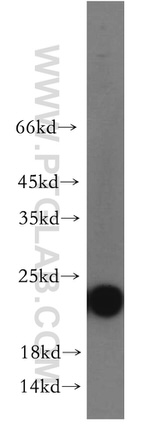 RAB11A Antibody in Western Blot (WB)