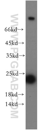 RAB11A Antibody in Western Blot (WB)