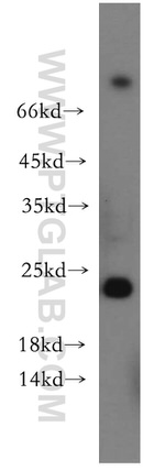 RAB11A Antibody in Western Blot (WB)