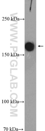 TOP2A Antibody in Western Blot (WB)