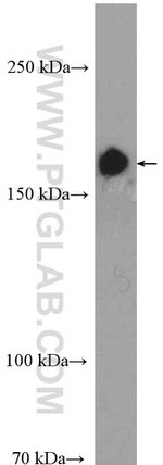 TOP2A Antibody in Western Blot (WB)