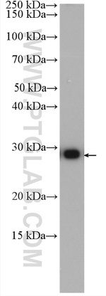 CSNK2B Antibody in Western Blot (WB)