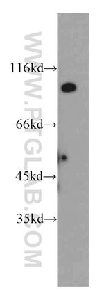 UNC5A Antibody in Western Blot (WB)