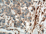 YES1 Antibody in Immunohistochemistry (Paraffin) (IHC (P))