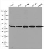 YES1 Antibody in Western Blot (WB)