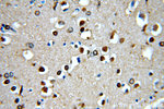 ROCK2(C-term) Antibody in Immunohistochemistry (Paraffin) (IHC (P))