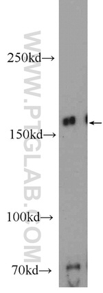 ROCK2(C-term) Antibody in Western Blot (WB)