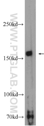 ROCK2(C-term) Antibody in Western Blot (WB)