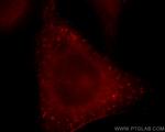 ROCK2(C-term) Antibody in Immunocytochemistry (ICC/IF)