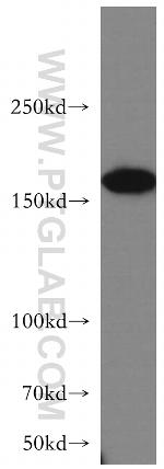 ROCK2(C-term) Antibody in Western Blot (WB)