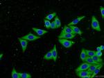 IGF2R Antibody in Immunocytochemistry (ICC/IF)