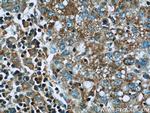 IGF2R Antibody in Immunohistochemistry (Paraffin) (IHC (P))