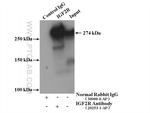 IGF2R Antibody in Immunoprecipitation (IP)