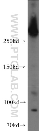 IGF2R Antibody in Western Blot (WB)