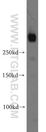 IGF2R Antibody in Western Blot (WB)