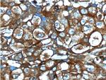 IGF1R beta chain Antibody in Immunohistochemistry (Paraffin) (IHC (P))