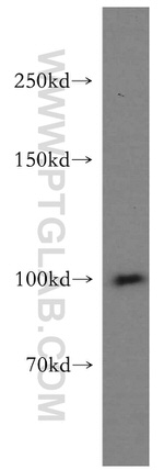 IGF1R beta chain Antibody in Western Blot (WB)