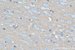 SYN1 Antibody in Immunohistochemistry (Paraffin) (IHC (P))